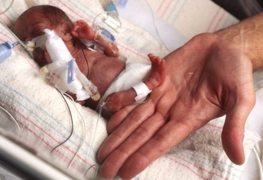 Japan: Baby überlebt mit nur 258 Gramm