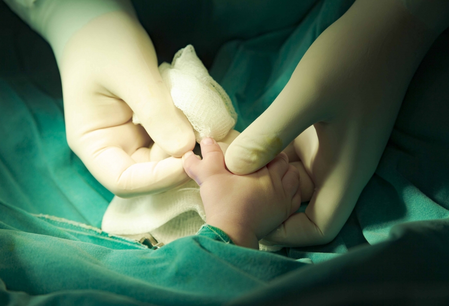 Tibb Universitetinin Tədris Cərrahiyyə Klinikasında altıbarmaqlı uşaq əməliyyat olunub