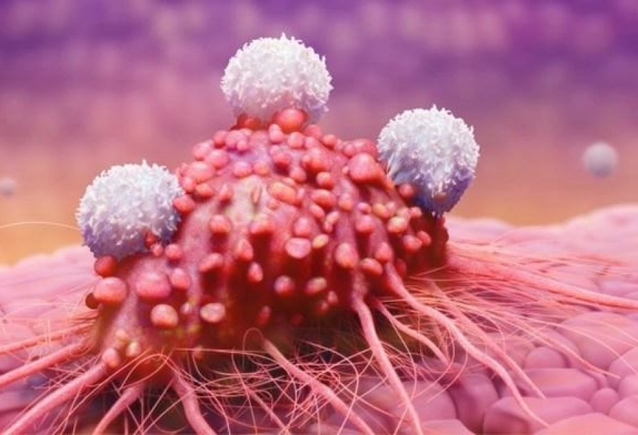 Найден способ остановить метастазирование рака