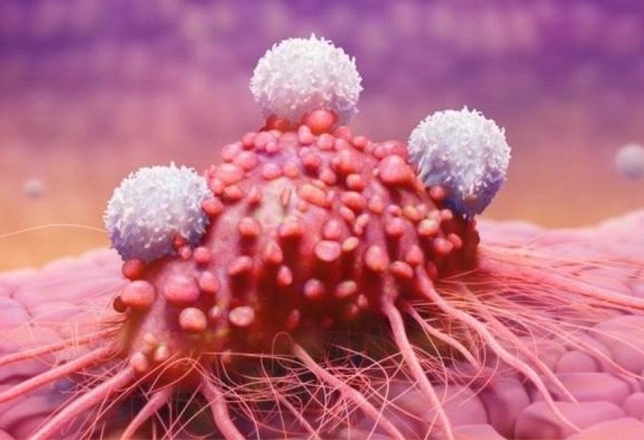 Британские ученые разрабатывают препарат, сдерживающий распространение рака в долгосрочной перспективе