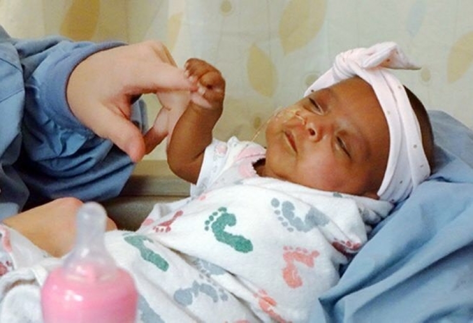 La bebé "más pequeña del mundo" que pesó 245 gramos al nacer y sobrevivió contra todas las expectativas