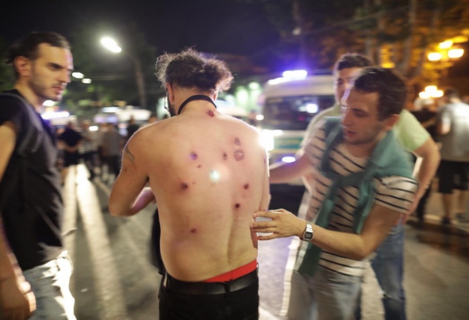 Tbilisidə keçirilən aksiyada 31 jurnalist yaralanıb