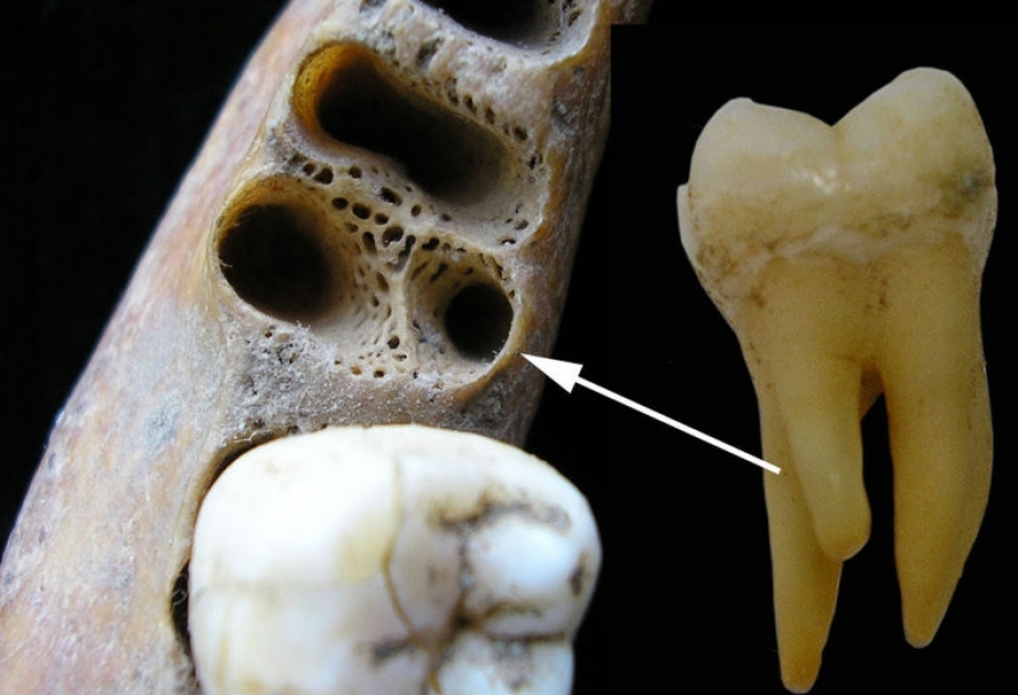 Encuentran evidencia de cruzamiento de 'Homo sapiens' con otra especie