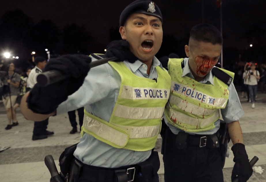 Honkonqda keçirilən qanunsuz aksiyalarda 179 polis əməkdaşı xəsarət alıb