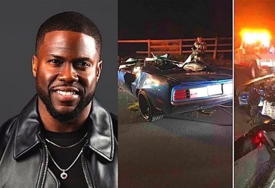 Hollivud ulduzu Kevin Hart avtoqəza nəticəsində ciddi xəsarət alıb