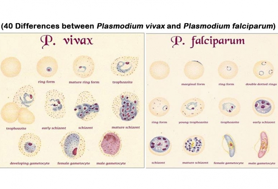 Different form. Малярии Vivax falciparum. Плазмодий Вивакс у человека. Малярийный плазмодий Вивакс. Плазмодиум малярия,Вивакс и фальципарум.