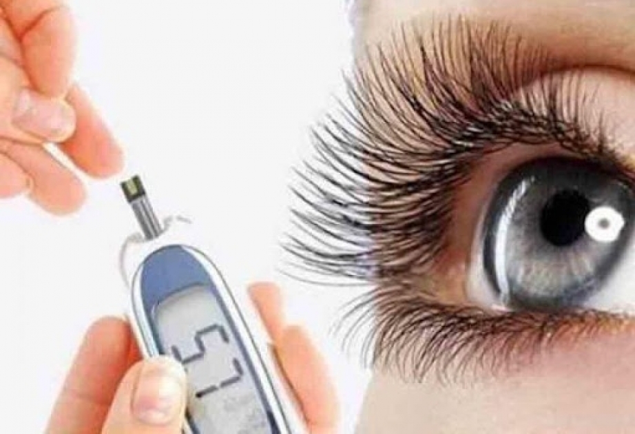 Diabetik retinopatiya ağır göz xəstəliyidir