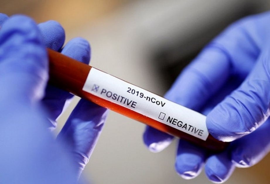 Украина получит тесты, определяющие наличие коронавируса за 15 минут