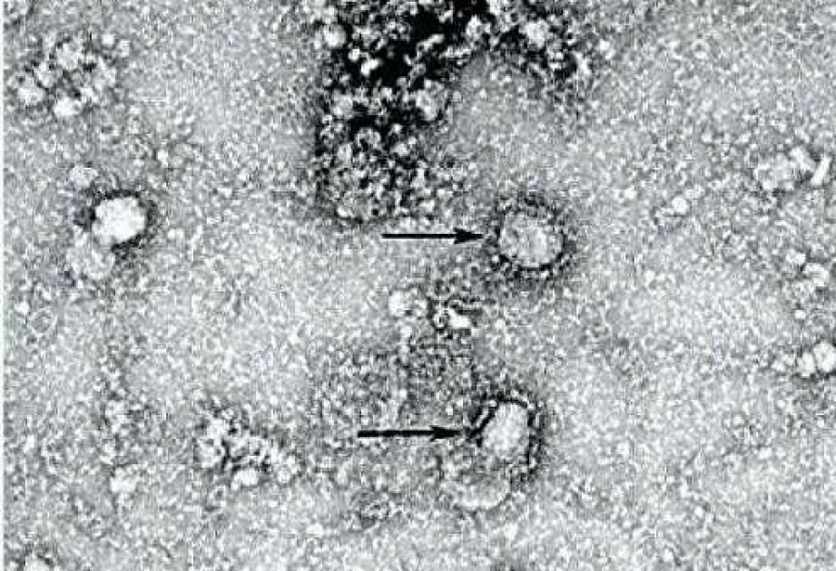 Ученые нашли вирус, являющийся ближайшим родственником COVID-19
