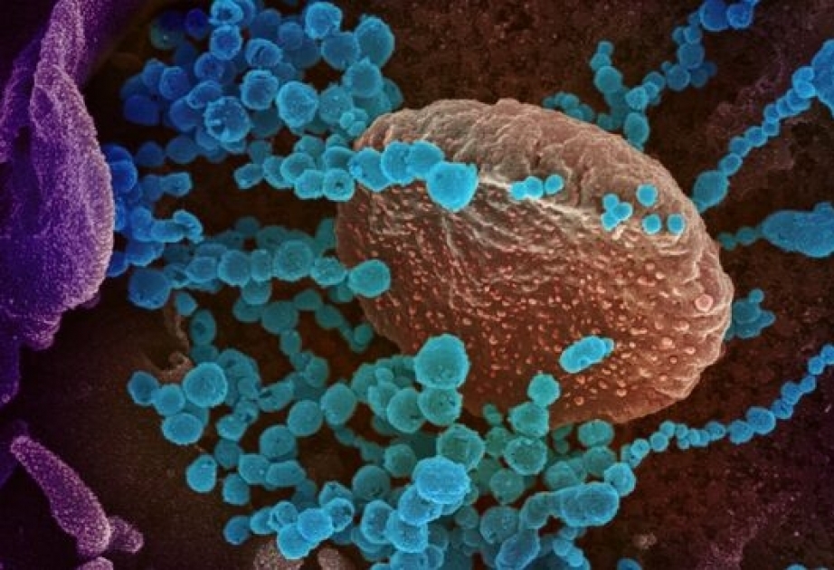 Científicos chinos descubren cómo el coronavirus se une a las células humanas