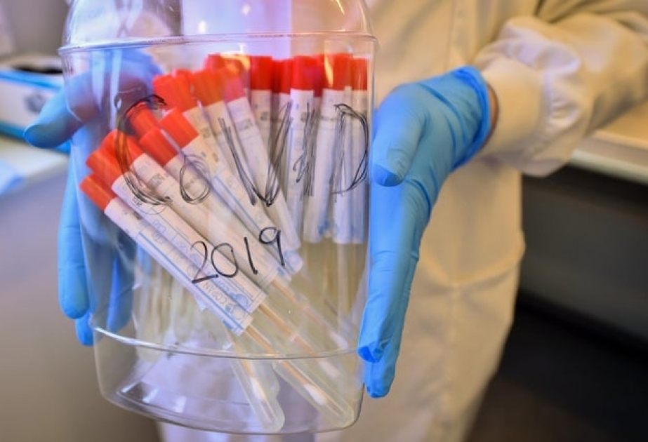 Britaniyada koronavirusdan ölənlərin sayı 21-ə çatıb
