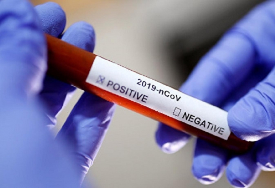 Ukrayna koronavirusu müəyyən edən testlərin kütləvi istehsalına başlayır