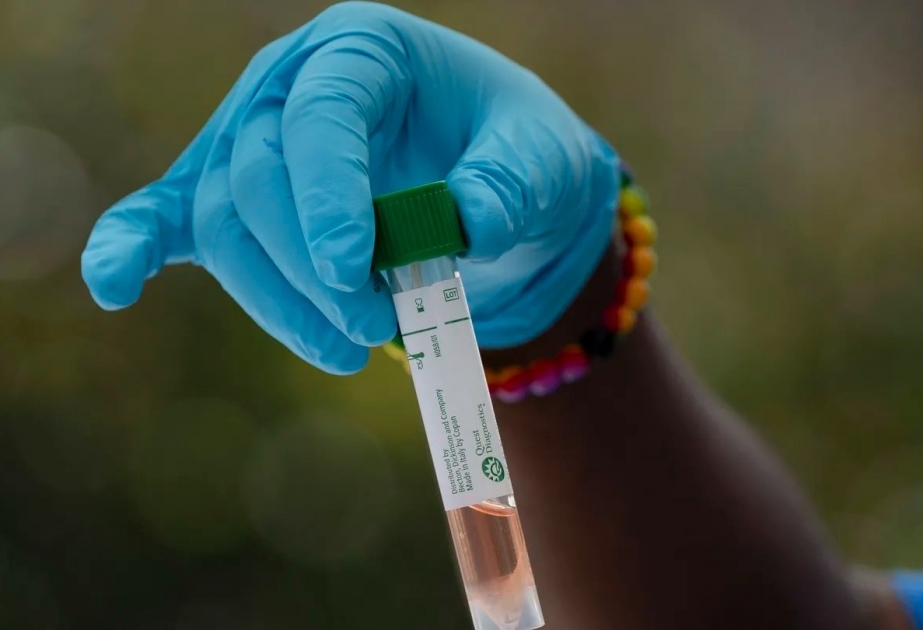 Sechs Wochen altes Baby an Folgen einer Coronavirus-Infektion gestorben