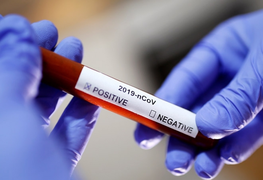 Cənubi Koreyada koronavirusun 20 dəqiqəlik analizi üçün reagent hazırlanıb