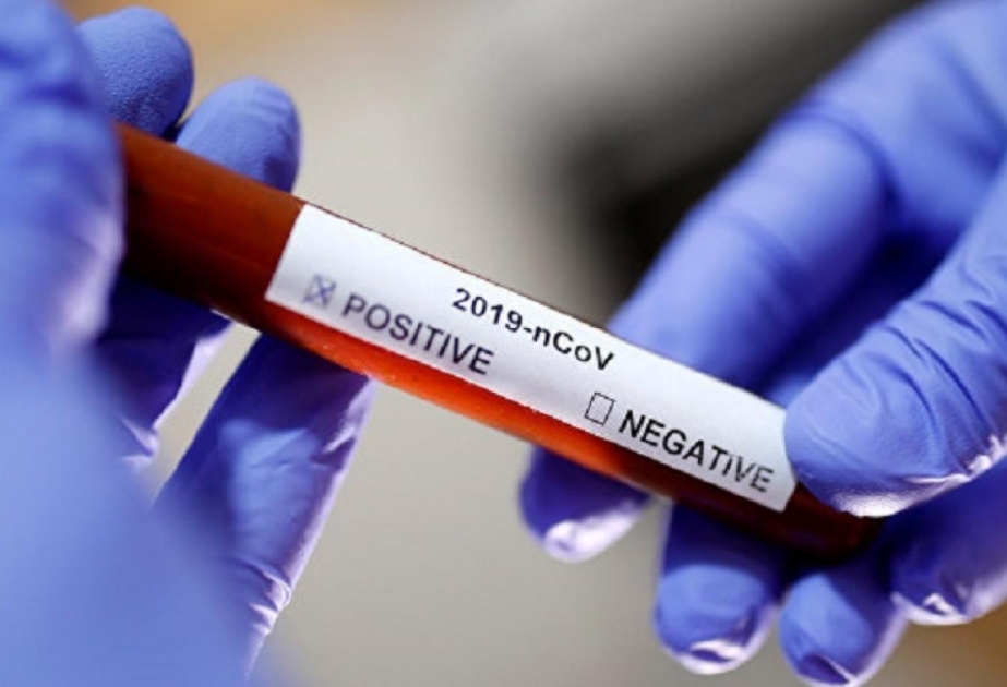 Belarusda koronavirus: 2578 nəfər yoluxub, 26-sı ölüb