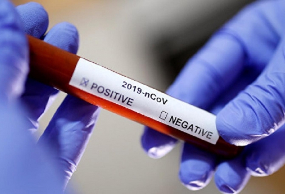 Ukraynada koronavirus 116 nəfərin həyatına son qoyub