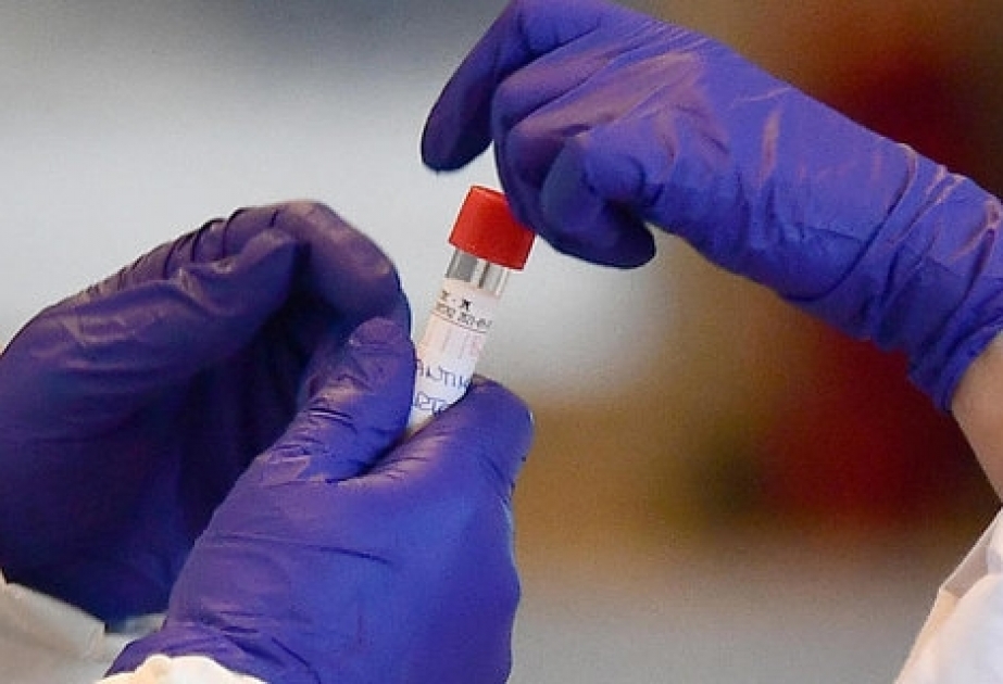 Российские ученые сообщили о завершении разработки тест-системы на антитела к вирусу


