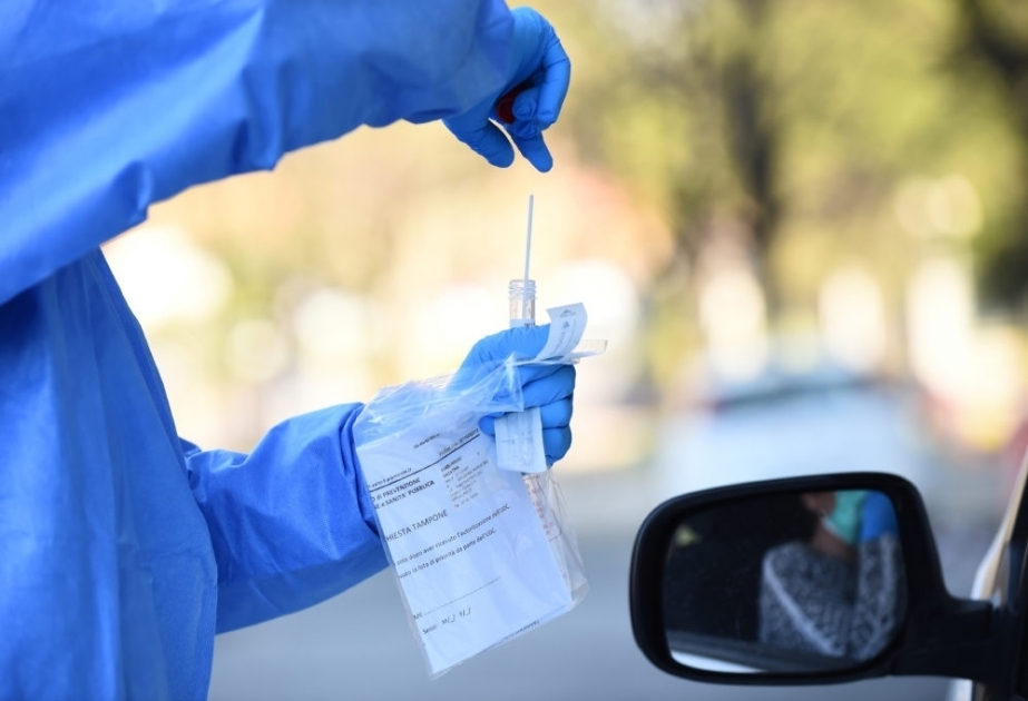 ABŞ koronavirusun ilk test paketindən ev şəraitində istifadə edilməsini bəyənir
