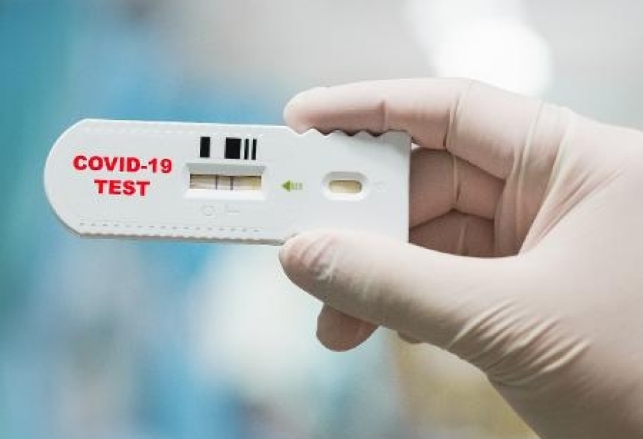 İtaliyada bir milyondan çox nəfər testdən keçirilib