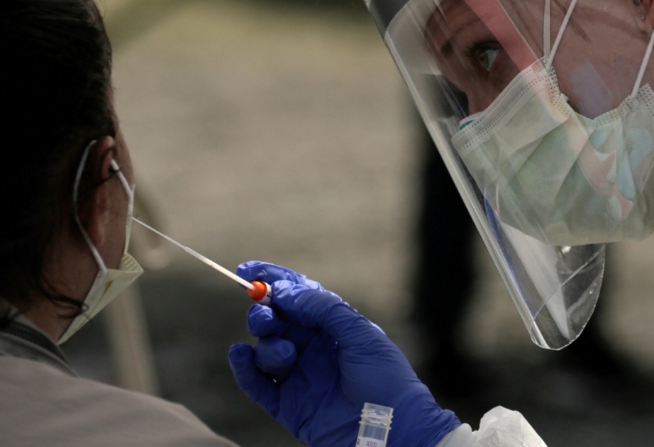 Los-Anceles sakinləri koronavirus testindən pulsuz keçə biləcək