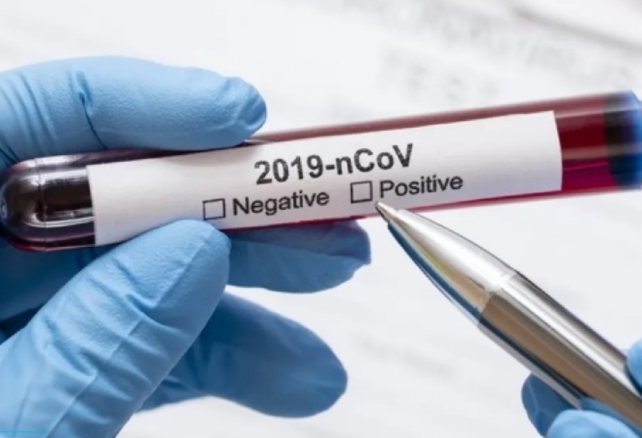 Coronavirus case in Uzbekistan reaches 2086