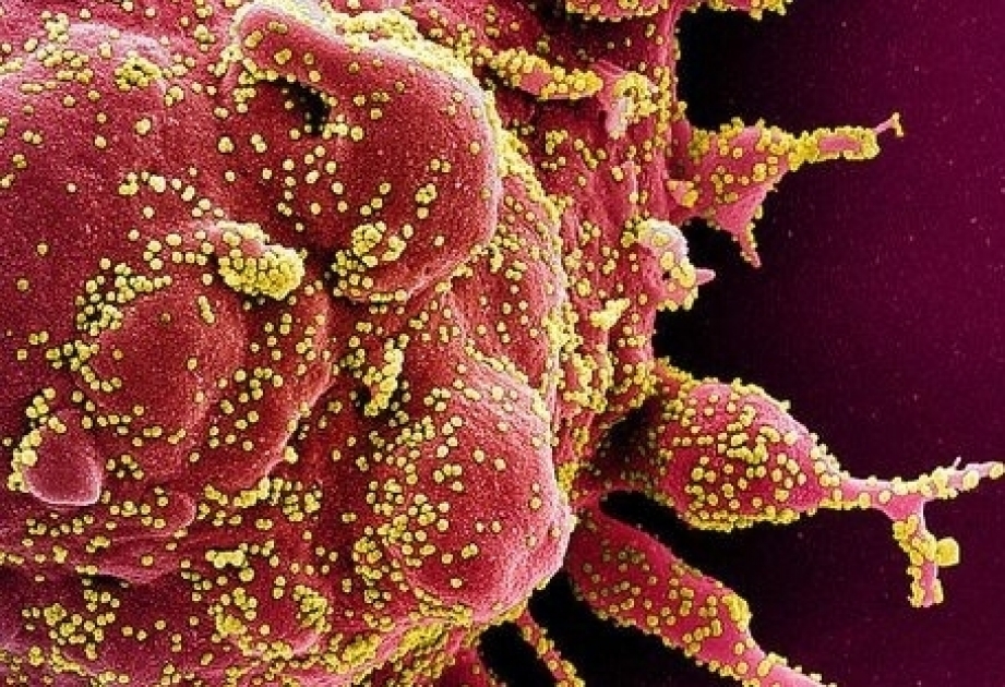 OMS: “El coronavirus puede quedarse con nosotros para siempre”
