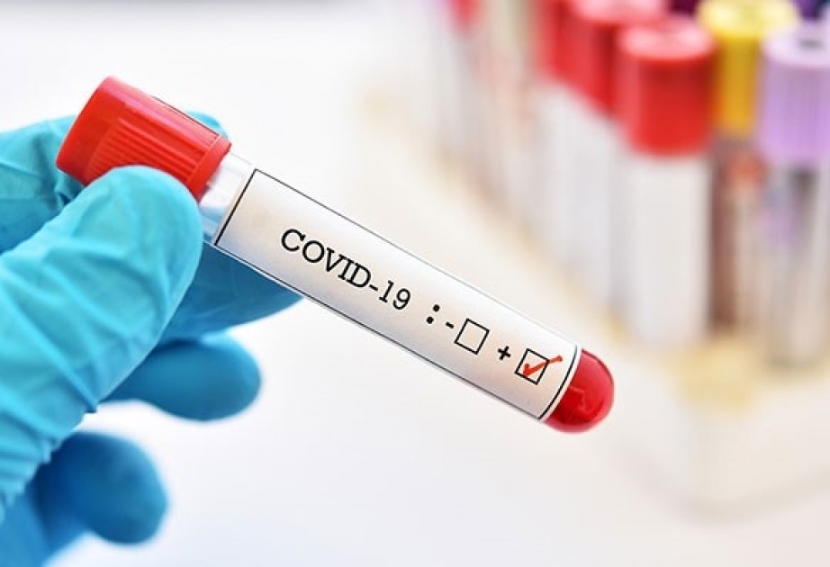 Azərbaycanda koronavirusa yoluxma hallarının aşkarlanması üçün daha 4325 test aparılıb