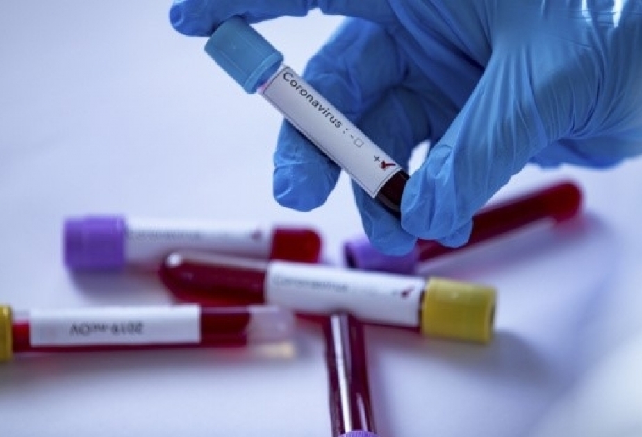 El número de pruebas realizadas para detectar COVID-19 en Azerbaiyán superó los 300,000
