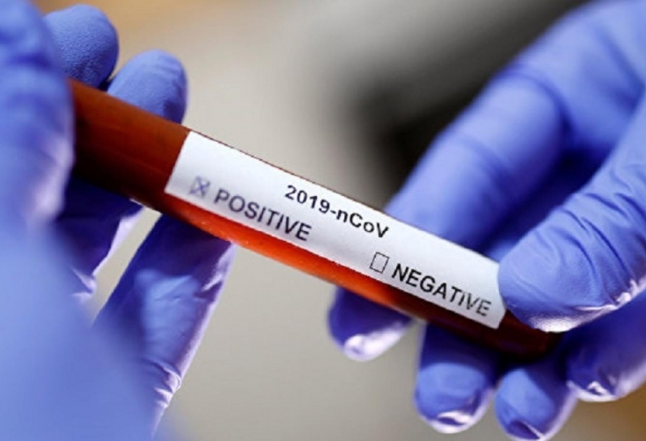 Le nombre des contaminés au coronavirus a diminué en Ukraine au cours des deux derniers jours