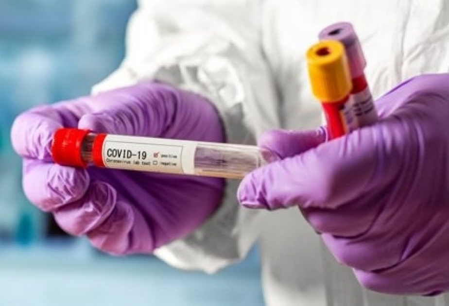 Farmacéuticas Zeytun ha donado 50.000 kits de prueba de COVID-19 al Ministerio de Salud