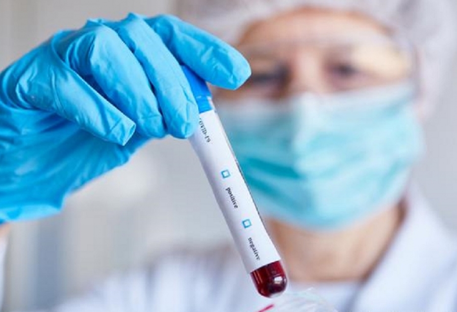 Yeni Zelandiyada son 24 gündə ilk dəfə koronavirusa yoluxma halı qeydə alınıb