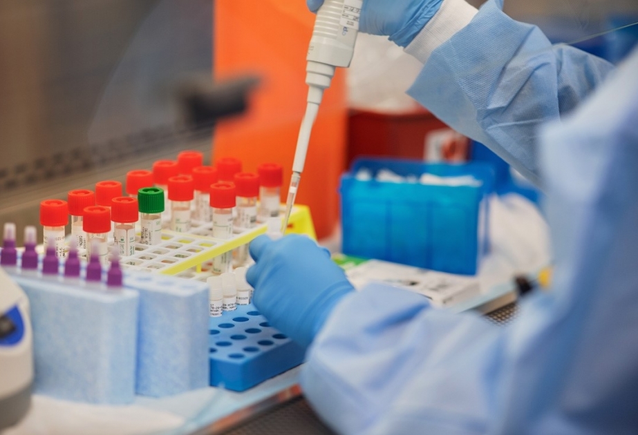 Azərbaycanda koronavirusa yoluxma hallarının müəyyənləşdirilməsi məqsədilə daha 4 min 801 test aparılıb