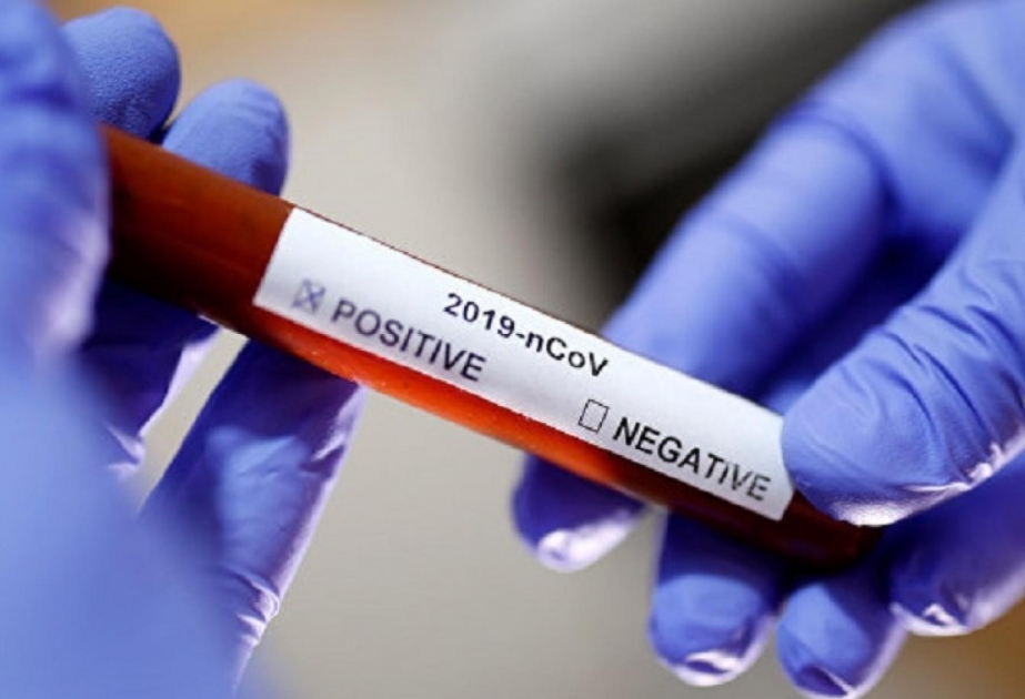 Belarusda koronavirus səbəbindən ölənlərin sayı 330 nəfəri ötüb