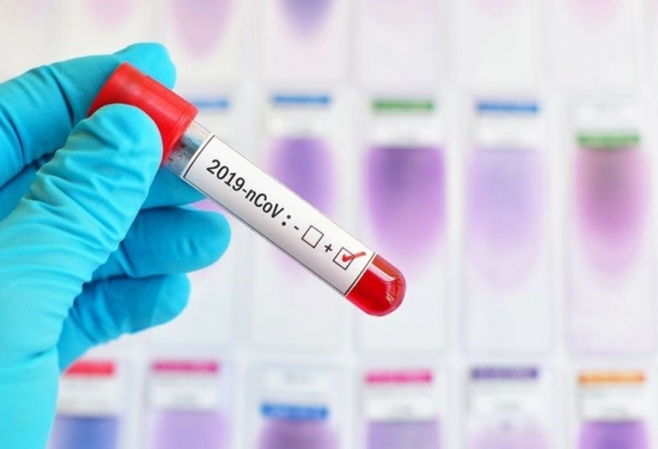 Koronavirusa yeni yoluxma hallarının müəyyənləşdirilməsi ilə əlaqədar daha 6980 test aparılıb