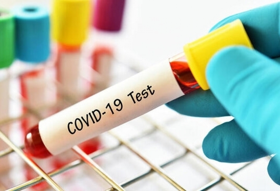 El 6 de julio se realizaron 6.240 pruebas de coronavirus en Azerbaiyán