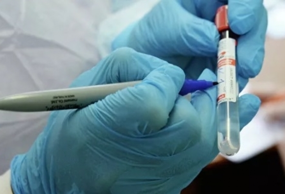 Number of COVID-19 patients exceeds 246,000 across Pakistan