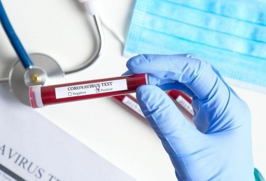 Koronavirusla əlaqədar ölkəmizdə 635 minə yaxın test aparılıb