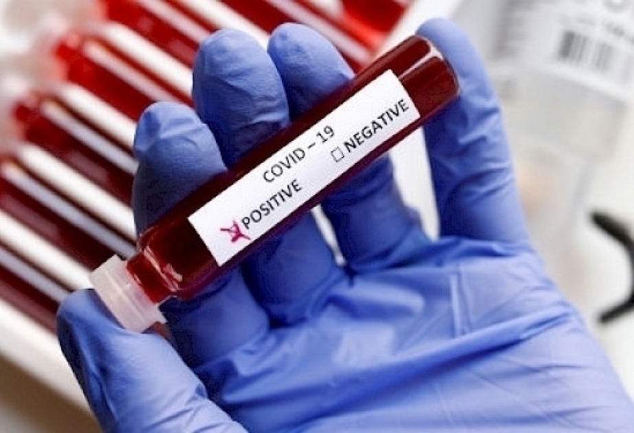 Uzbekistan surpasses 18,000 coronavirus cases
