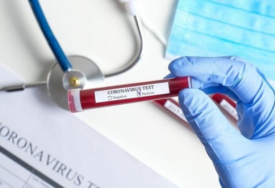 Se ha anunciado el número de pruebas de coronavirus realizadas en Azerbaiyán