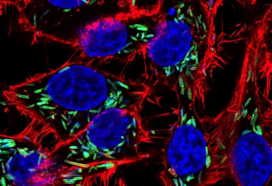 Alimlər: Ağız boşluğundakı bakteriyalar bağırsaq xərçəngini sürətləndirə bilər