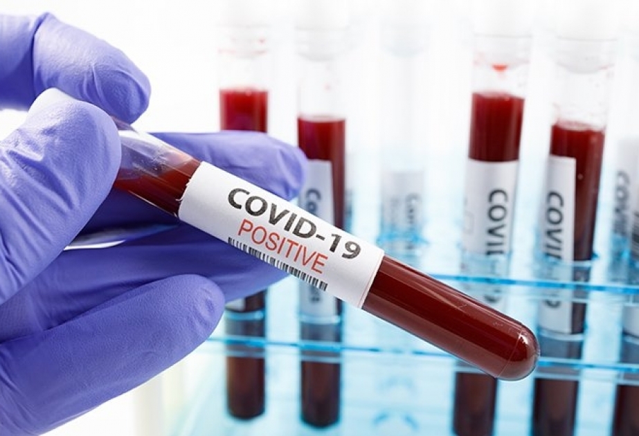 Dünyada koronavirus infeksiyasına yoluxanların sayı 16 milyonu ötüb