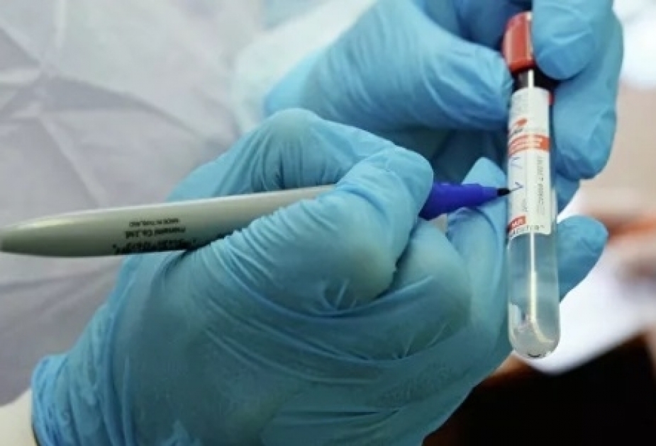 Le Pakistan compte au total 272 mille cas de contamination au coronavirus