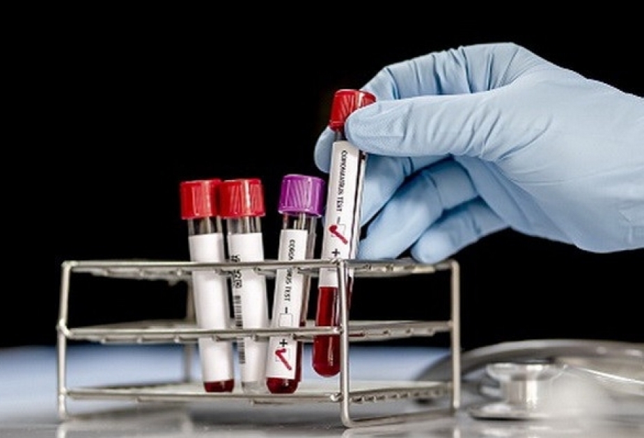 Son sutkada Pakistanda 23 nəfər koronavirusdan dünyasını dəyişib