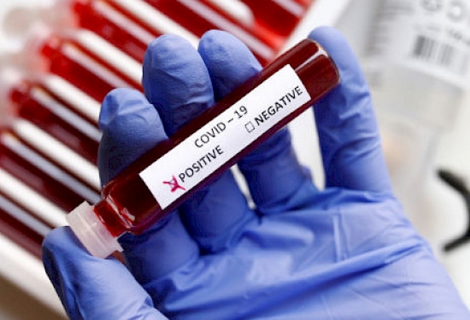 Son sutkada Qırğızıstanda koronavirusdan 14 nəfər ölüb