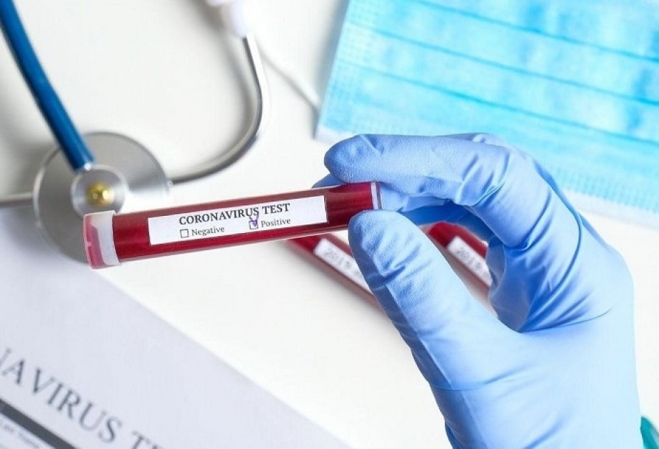 Azərbaycanda koronavirusa yoluxma hallarının müəyyənləşdirilməsi ilə əlaqədar daha 7883 test aparılıb