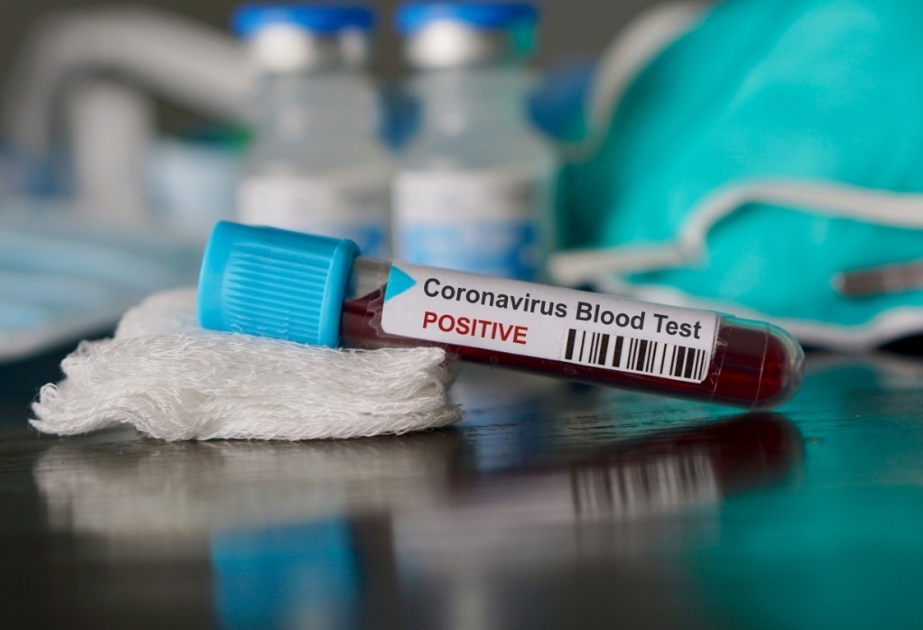La Roumanie confirme au total plus de 60 mille cas de contamination au coronavirus