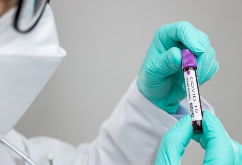 Qırğızıstan Rusiyadan koronavirus əleyhinə vaksin almağı planlaşdırır