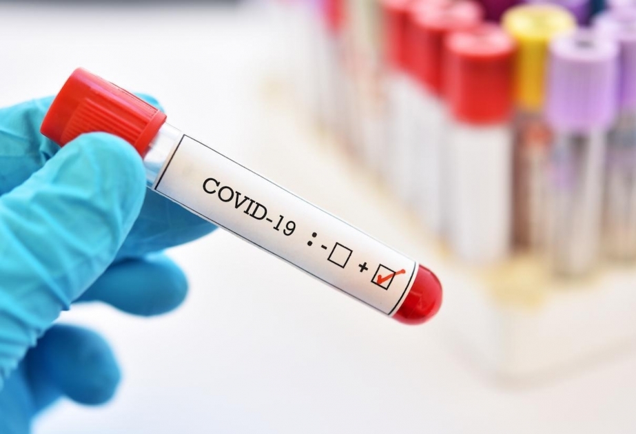 Coronavirus in Pakistan: 747 neue Fälle in 24 Stunden
