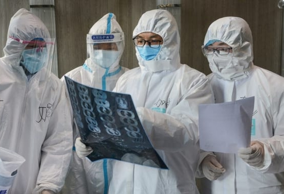 Dünyada koronavirus infeksiyasına yoluxanların sayı 22 milyon nəfəri ötüb