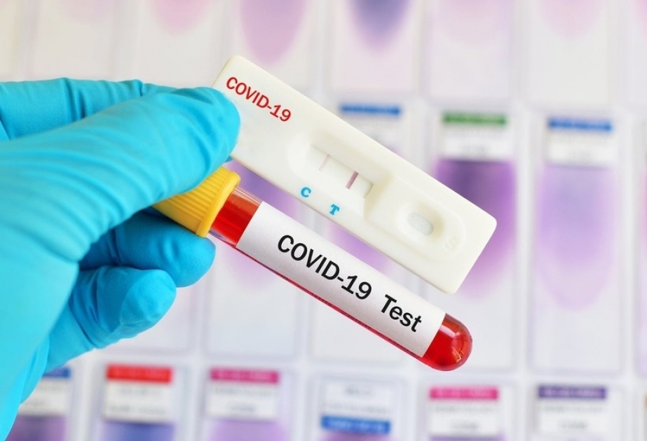 Qırğızıstanda COVID-19-a yoluxanların sayı 43 mini keçib